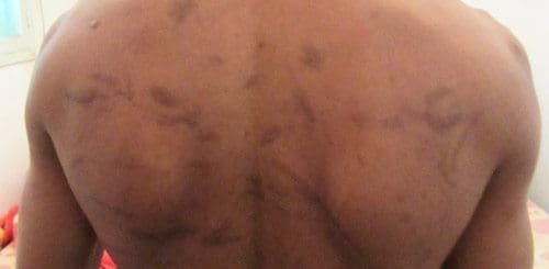 libya_back_of_tortured_man-500x245.jpg