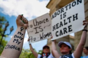 A woman holds up her arm with
